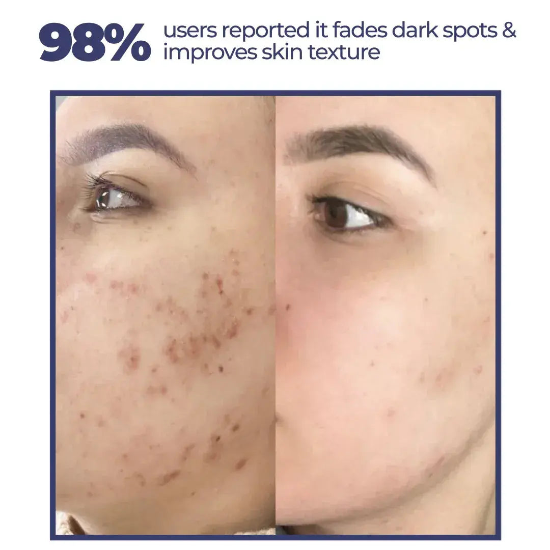 Refine  | Dark Spot Correcting Serum | Niacinamide & Tranexamic Acid | 30ml GG Organics