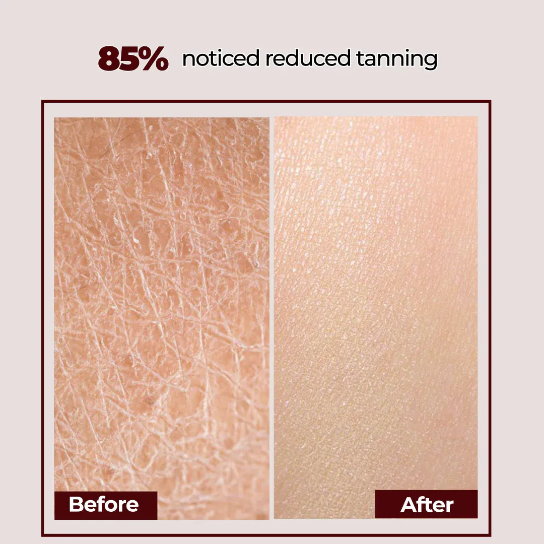 Softura Plus Moisturizer Intense Hydration For 24 Hours 100gm GG Organics