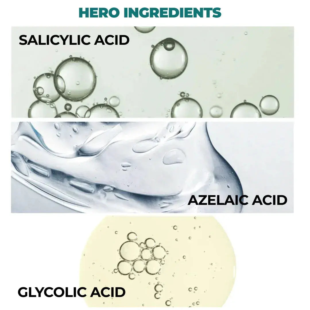 Defensor | Acne Treatment Serum | Salicylic Acid - Azelaic Acid & Glycolic Acid | 30ml GG Organics