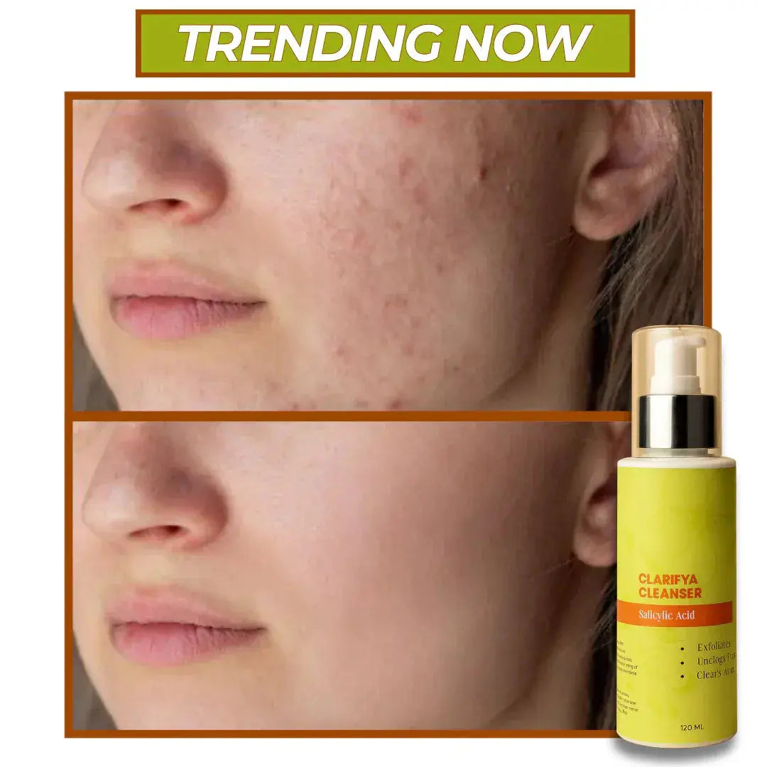 Clarifya Cleanser | Exfoliating & Clears Active Acne Gel | Salicylic Acid | 120ml GG Organics