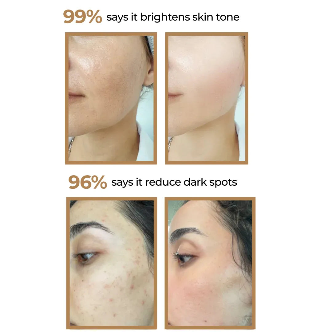 Skin Glow Brightening Cream | 50 gm GG Organics