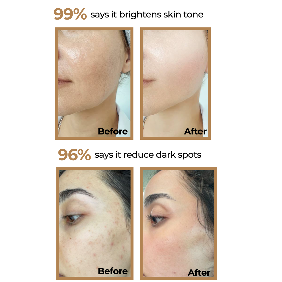 Skin Bright Kit