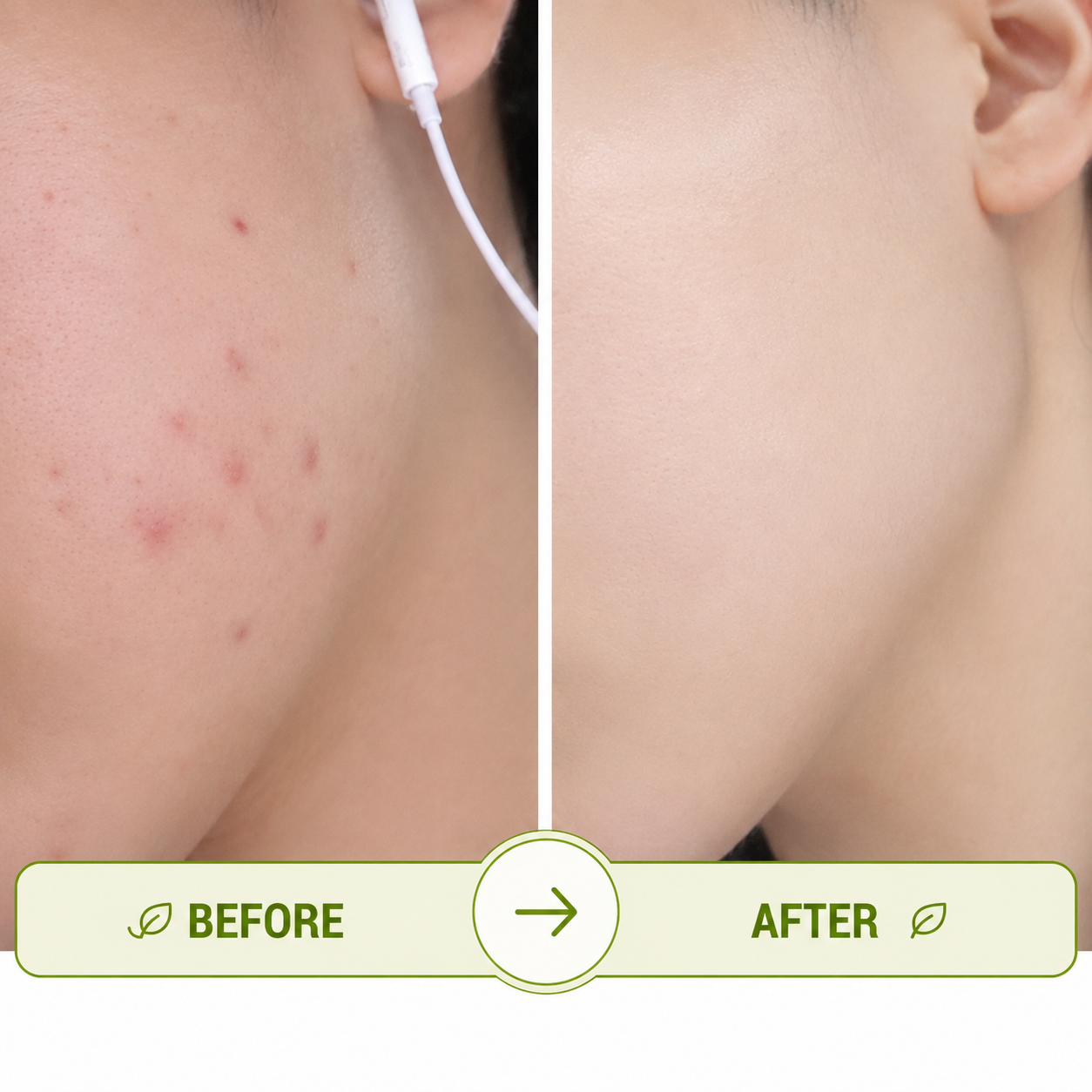 Clarifya | Salicylic Acid Gel Cleanser | 120ml