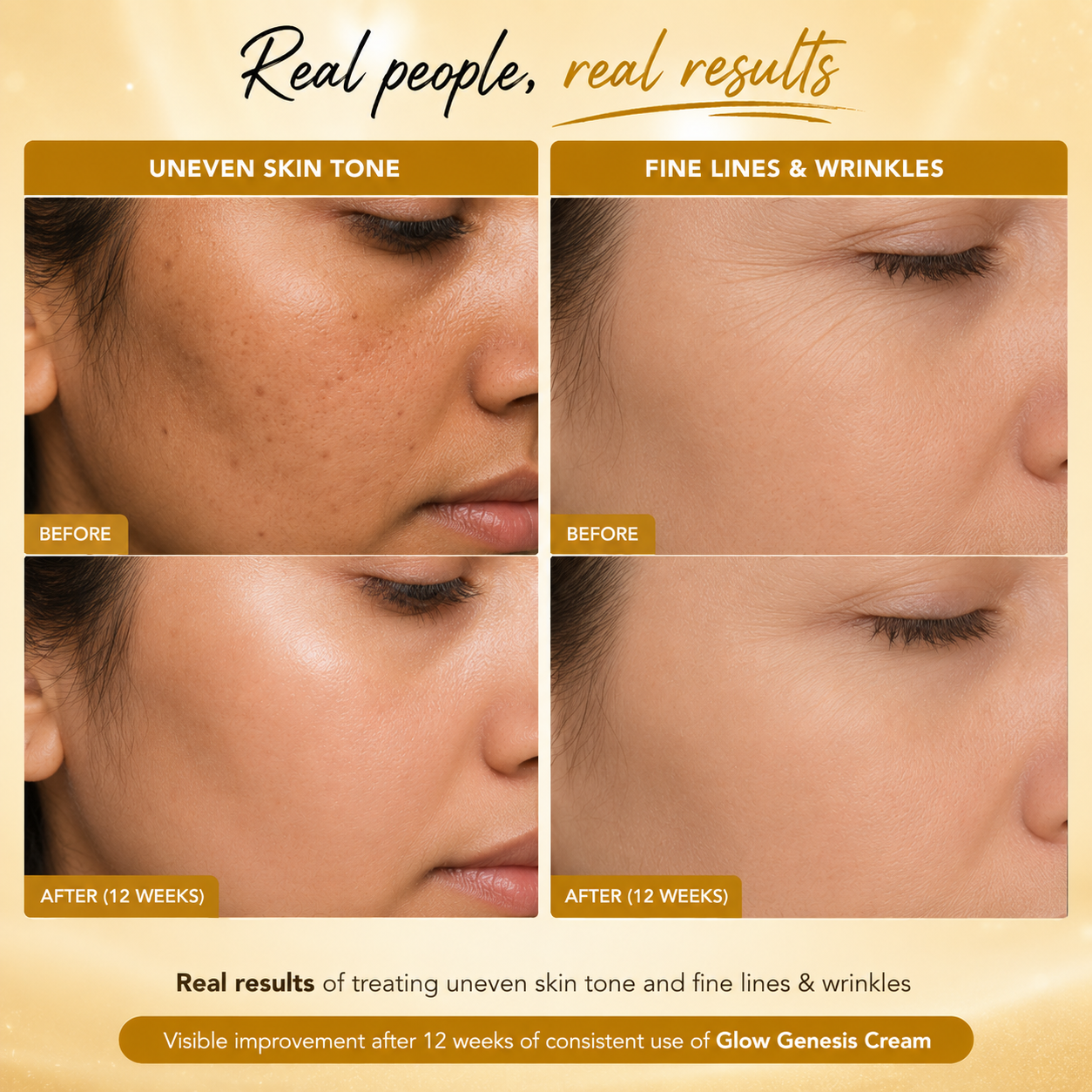 Glow Genesis Cream | Skin Lightening Treatment | 50 gm