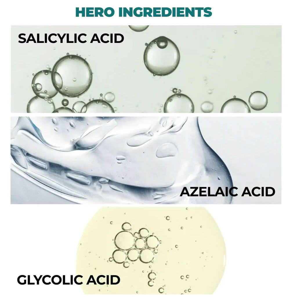 Defensor | Acne Treatment Serum | Salicylic Acid - Azelaic Acid & Glycolic Acid | 30ml