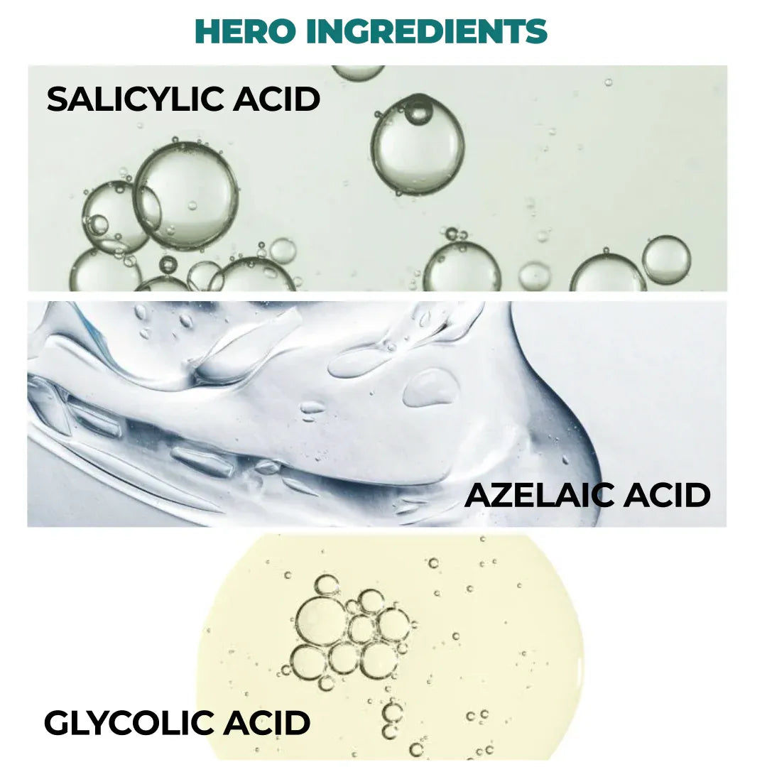 Defensor | Acne Treatment Serum | Salicylic Acid - Azelaic Acid & Glycolic Acid | 30ml